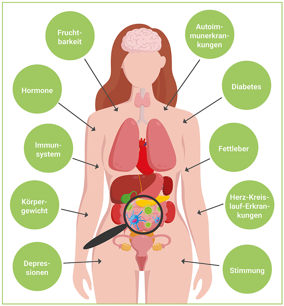 infografik-einfluss-der-darmgesundheit-auf-den-koerper