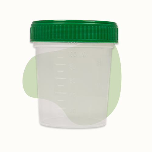 1 Urinbecher