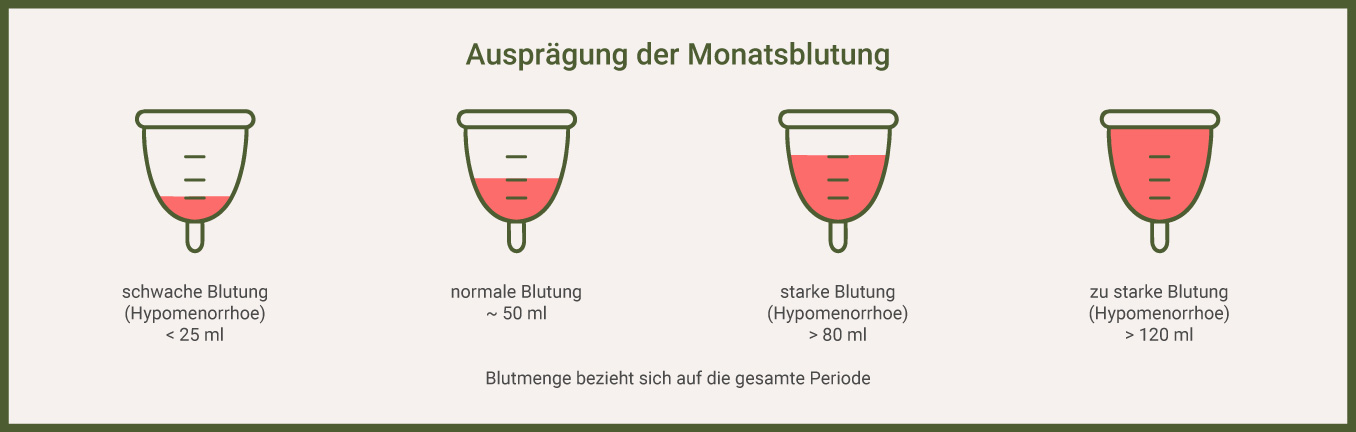 Ausprägung der Monatsblutung Infografik: Ausprägung der Monatsblutung