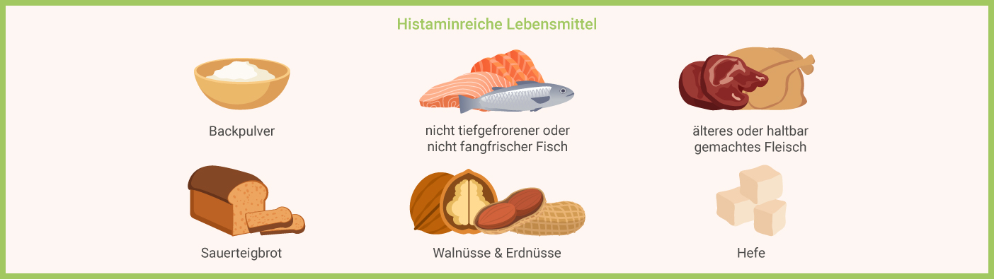 Histaminreiche Lebensmittel Infografik: Histaminreiche Lebensmittel
