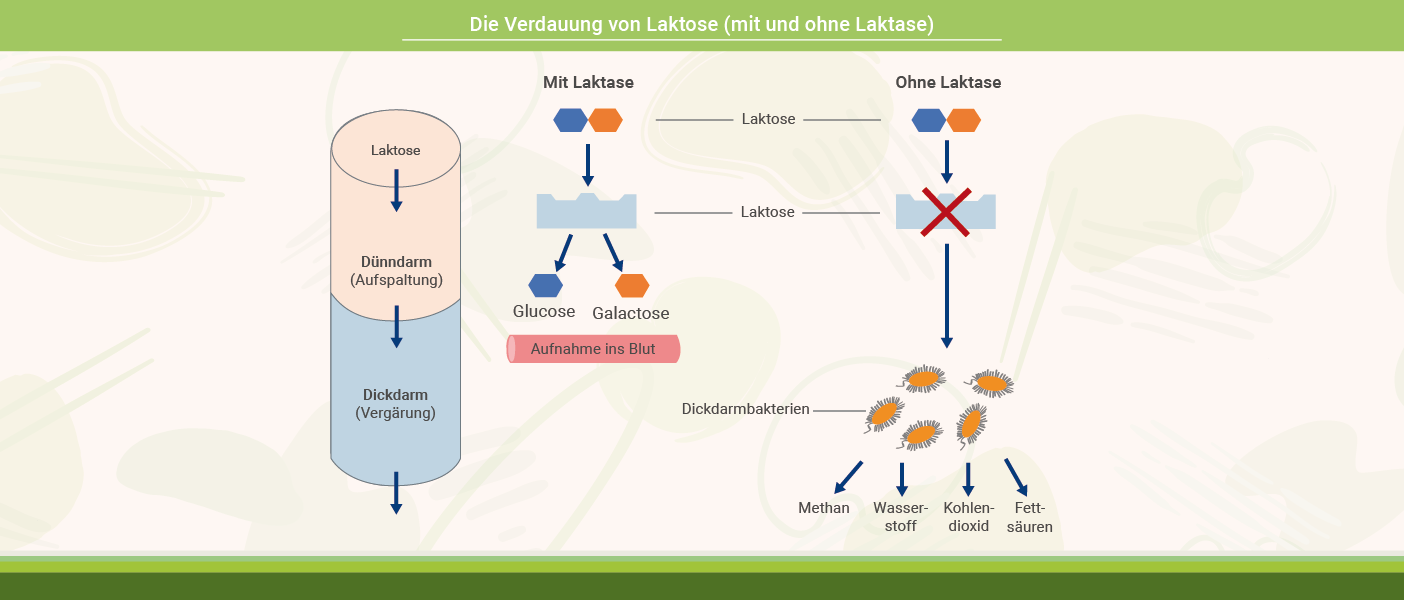 Infografik: Verdauung von Laktose