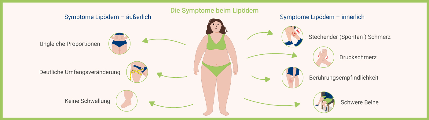 Symptome Lipödemv Infografik: Symptome Lipödem