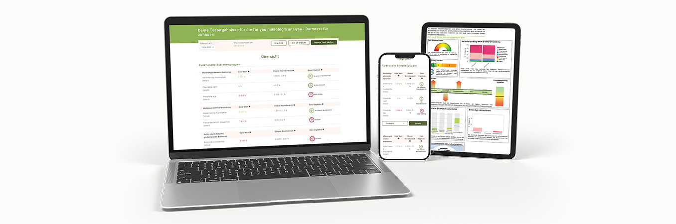 Mikrobiomanalyse und Ergebnisdarstellung - als Schaubild