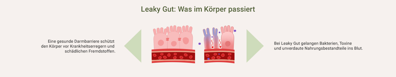 Leaky Gut Syndrom Test - Was ist Leaky Gut als Infografik